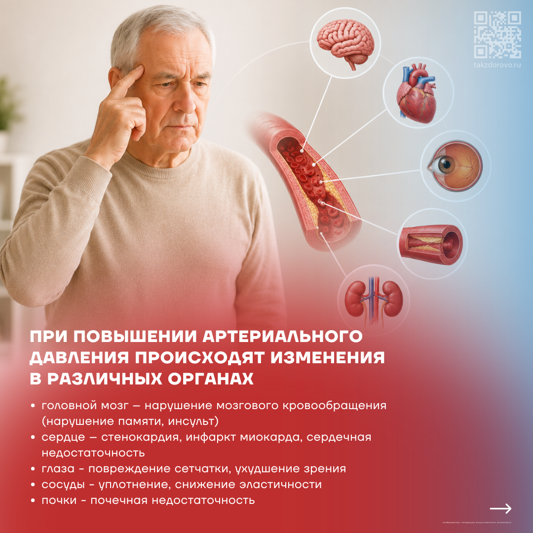 Артериальная гипертензия